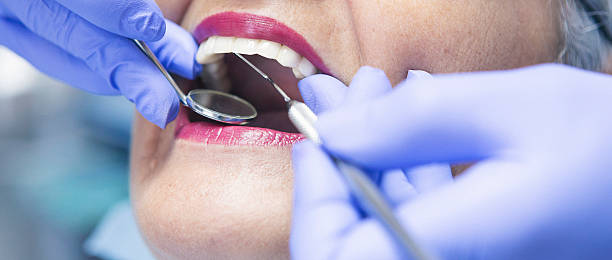 Best Emergency Dental Surgery in Athens, GA